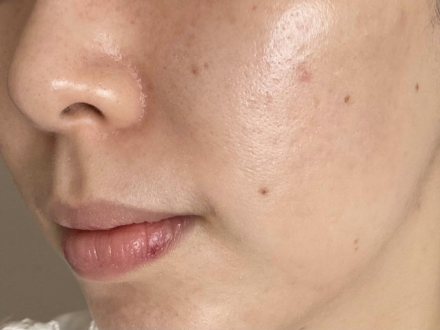 真っ黒なduoの口コミ調査 話題の毛穴効果は本当 トラコス