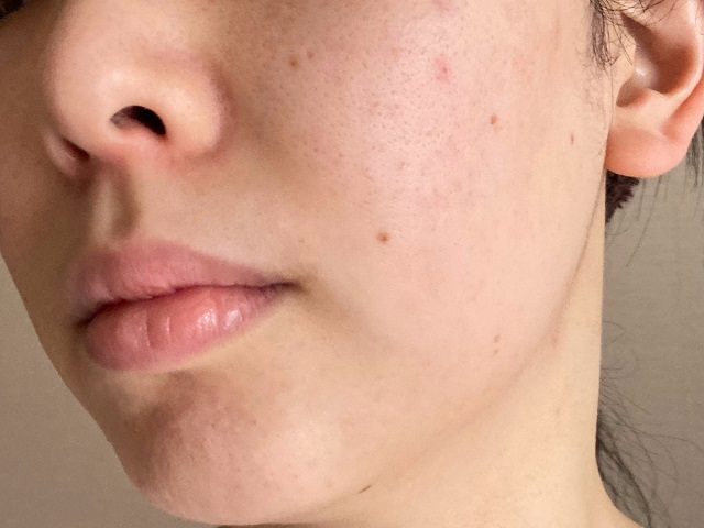 真っ黒なduoの口コミ調査 話題の毛穴効果は本当 トラコス